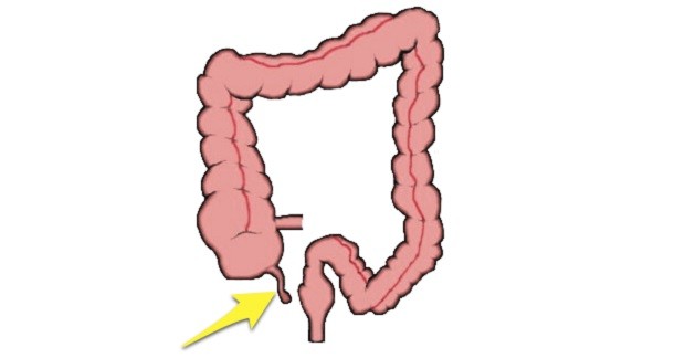 Dove Si Trova L Appendice Nel Corpo Umano