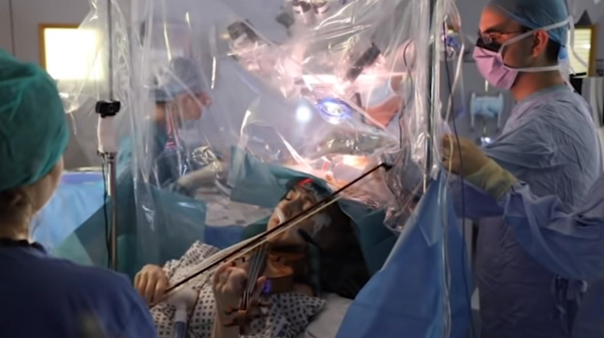 Musicista britannica suona il violino mentre la operano al cervello