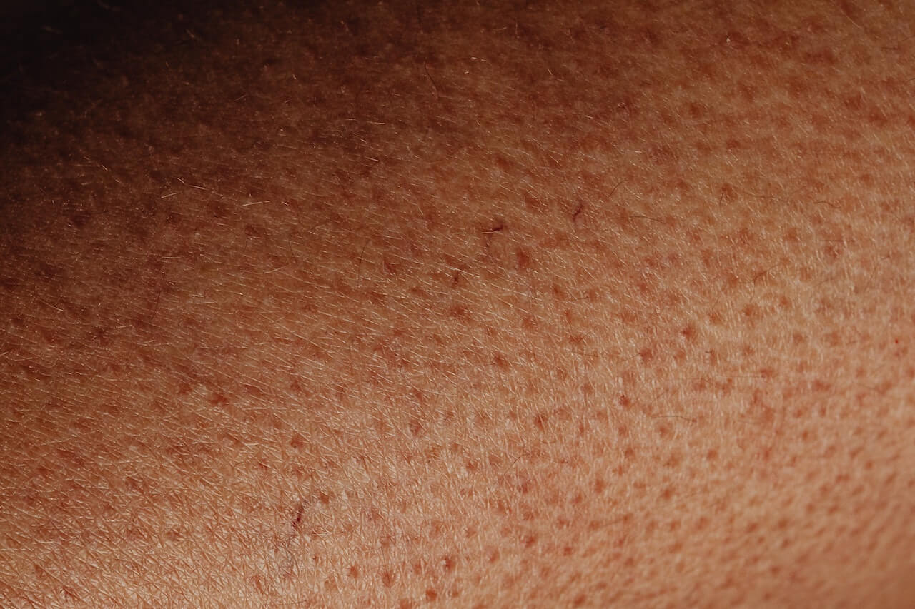 crema post depilazione anti follicolite