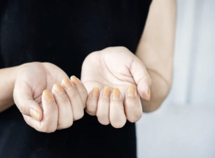 Avere unghie belle e sane non è solo una questione di bellezza estetica;