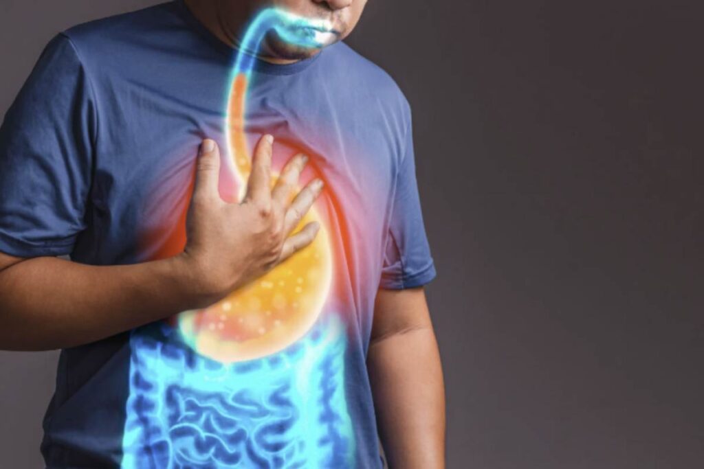 Le alte temperature, insieme a modifiche nelle abitudini alimentari tipiche della stagione estiva, contribuiscono a intensificare i sintomi